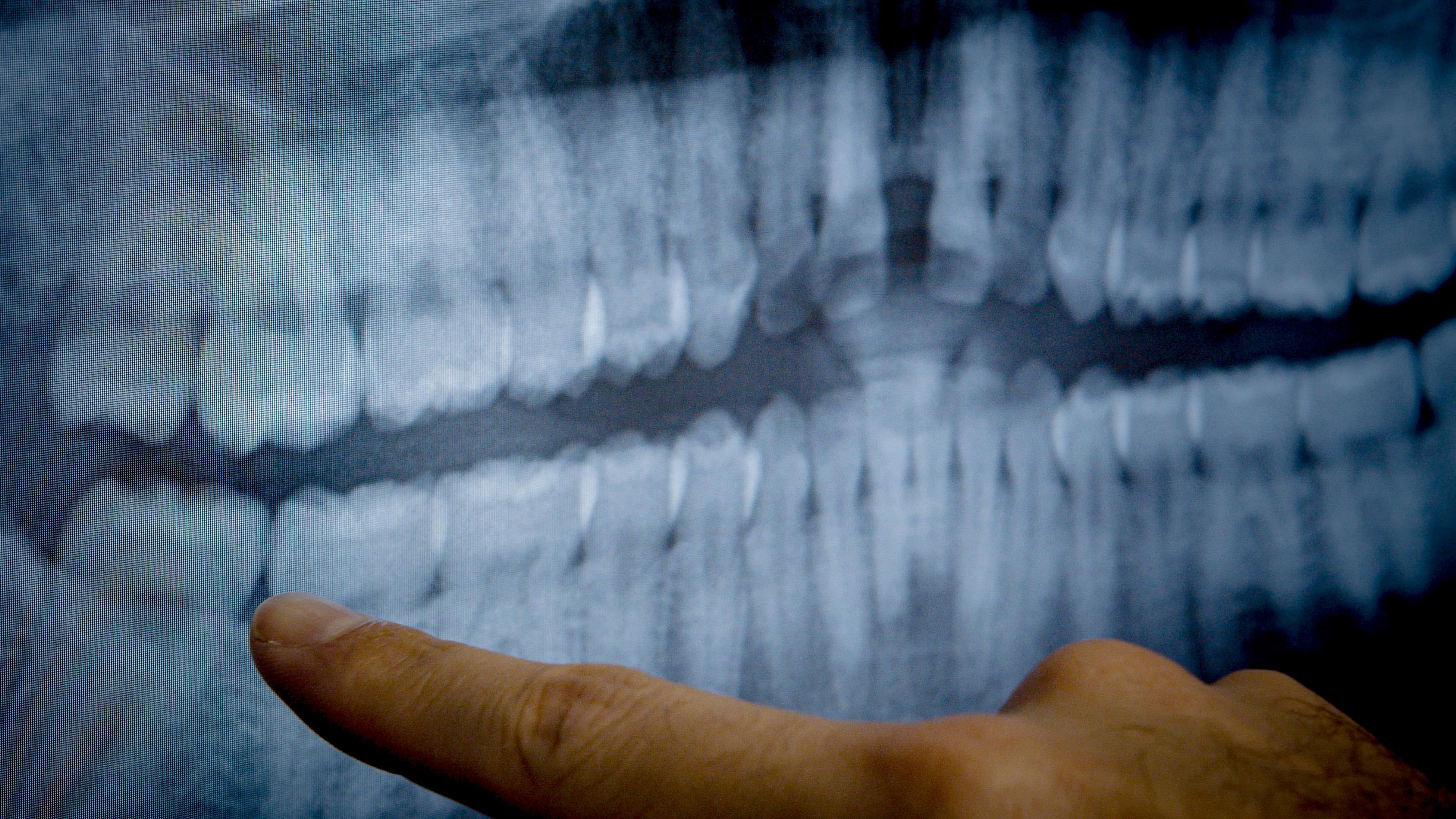 Clear Braces Lake Nona Orthodontist Esteem Dental & Orthodontics in