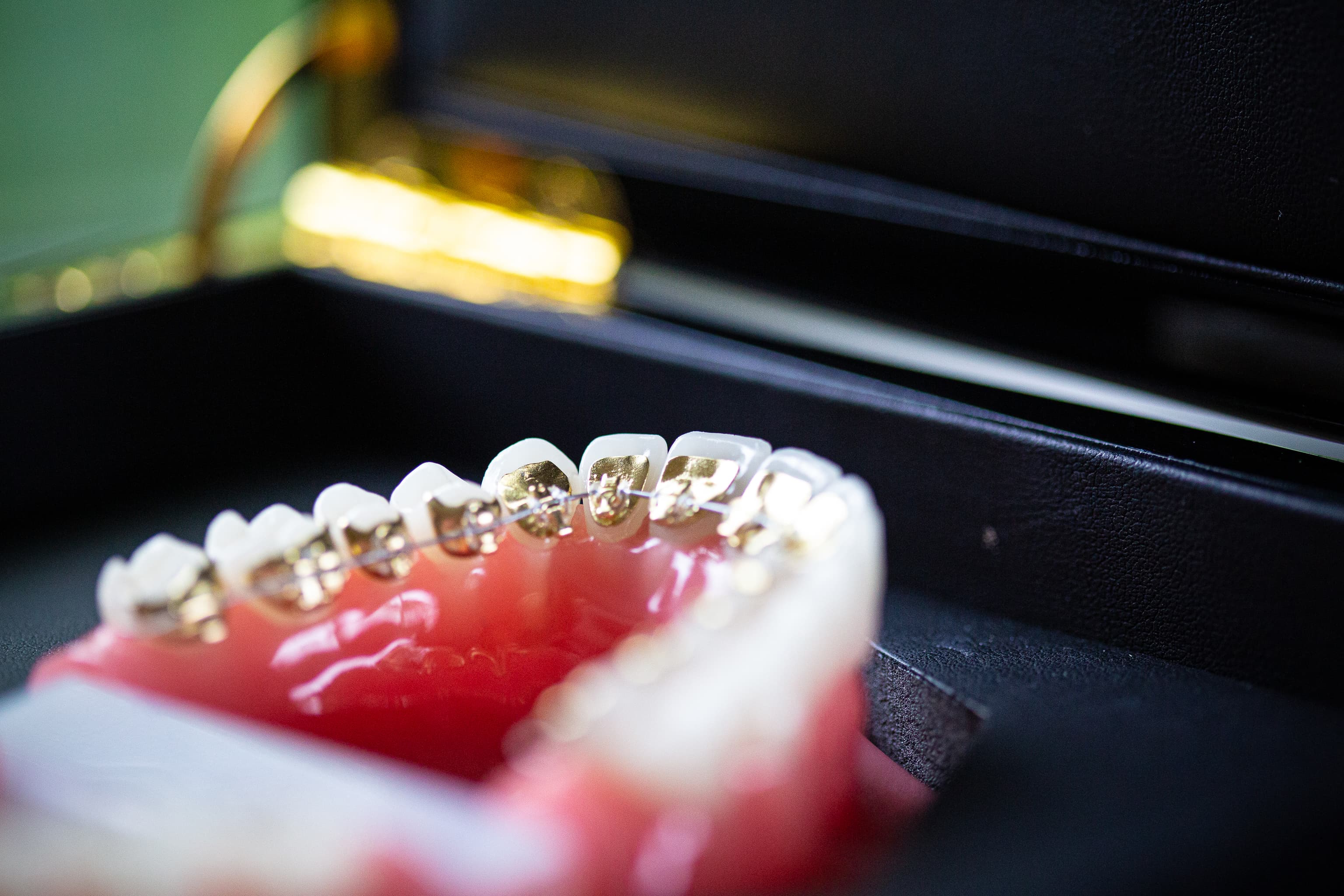 Clear Braces Lake Nona Orthodontist Esteem Dental & Orthodontics in