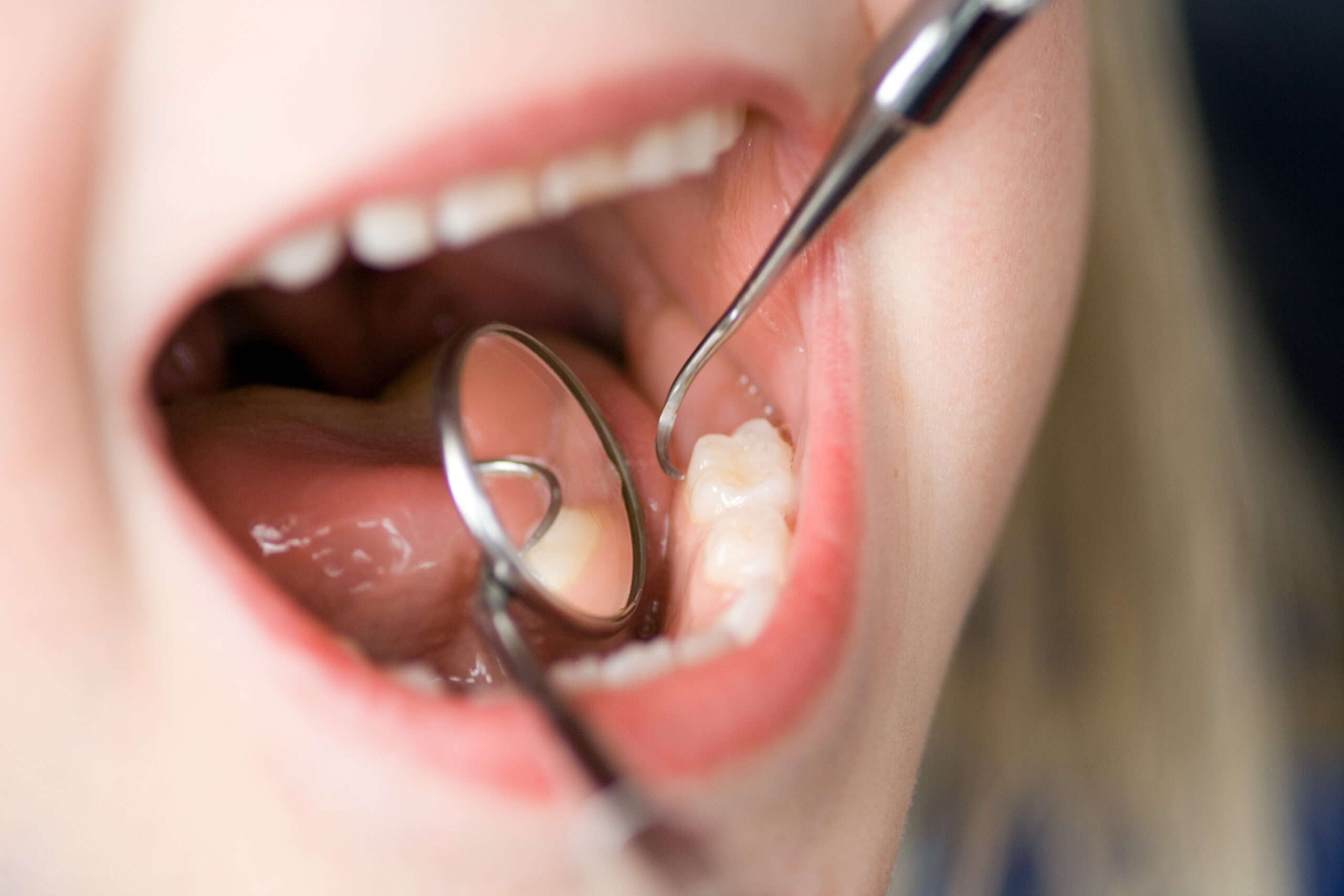 4 Qualities to Look For in a Florida Pediatric Dentist