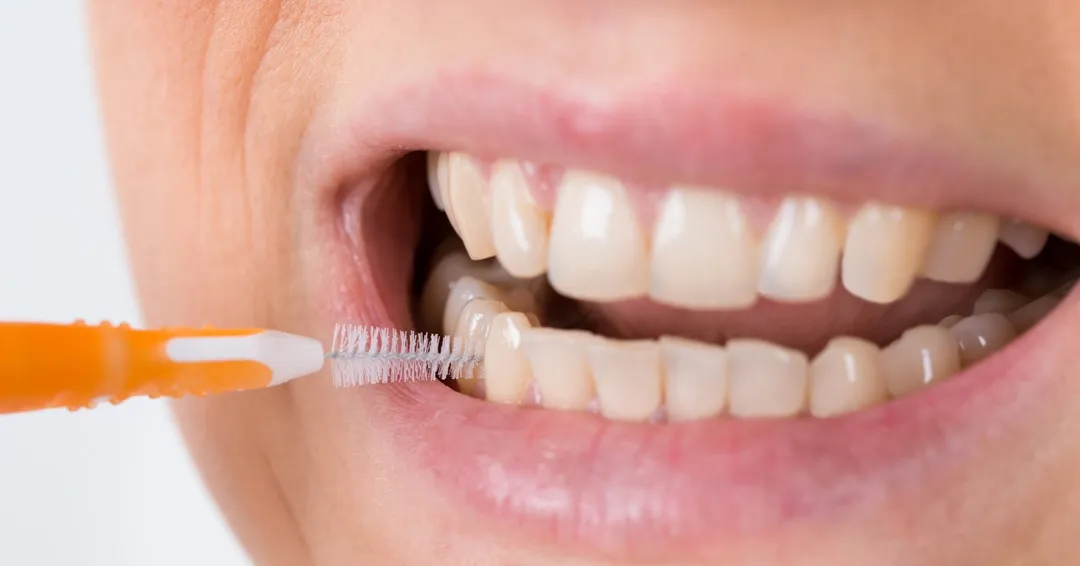 What Is Interdental Brushing, and Why Is It Important?