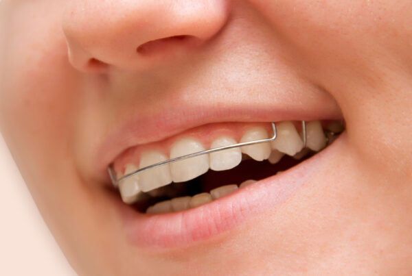 the girl smiling with braces on teeth