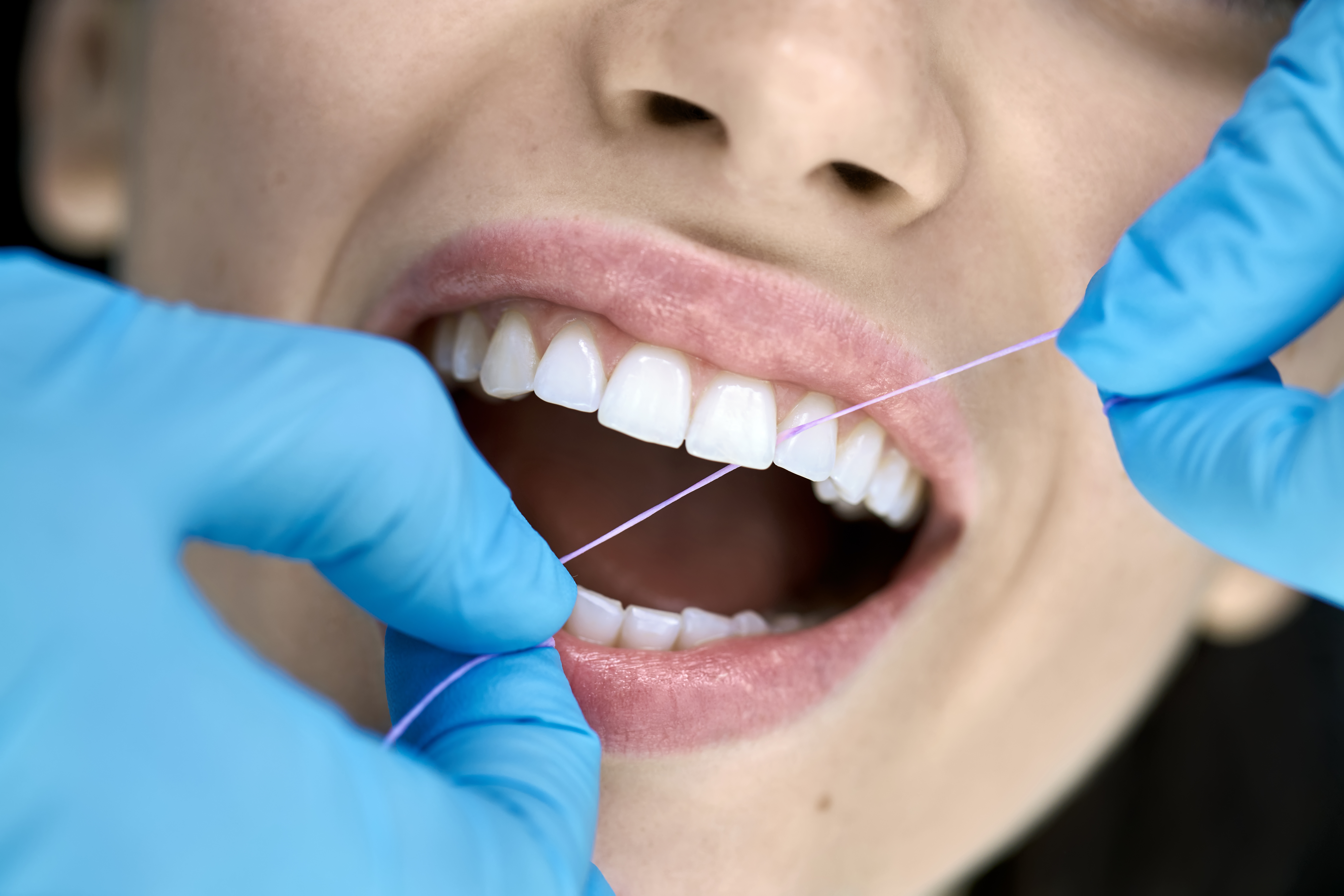 How Regular Dental Cleanings Can Save Your Family Money