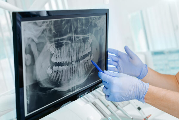 Hands doctor dentist in gloves show the teeth on x-ray on digital screen in dental clinic on light background with medical equipment. Smile healthy teeth concept, close up