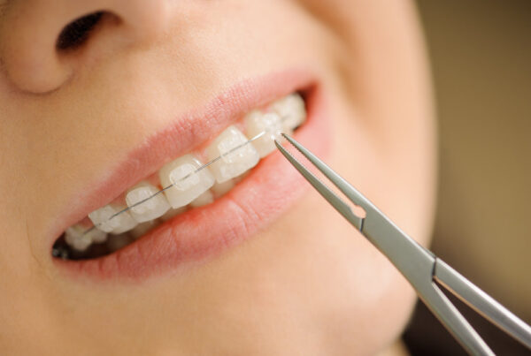 AdobeStock 109326042 - Esteem Dental & Orthodontics