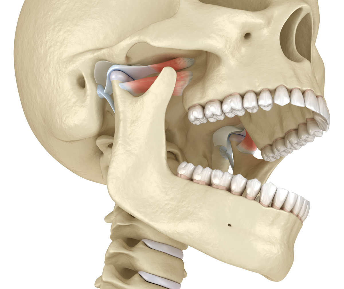 How Do I Know If My Jaw Pain Is TMJ or Something Else?