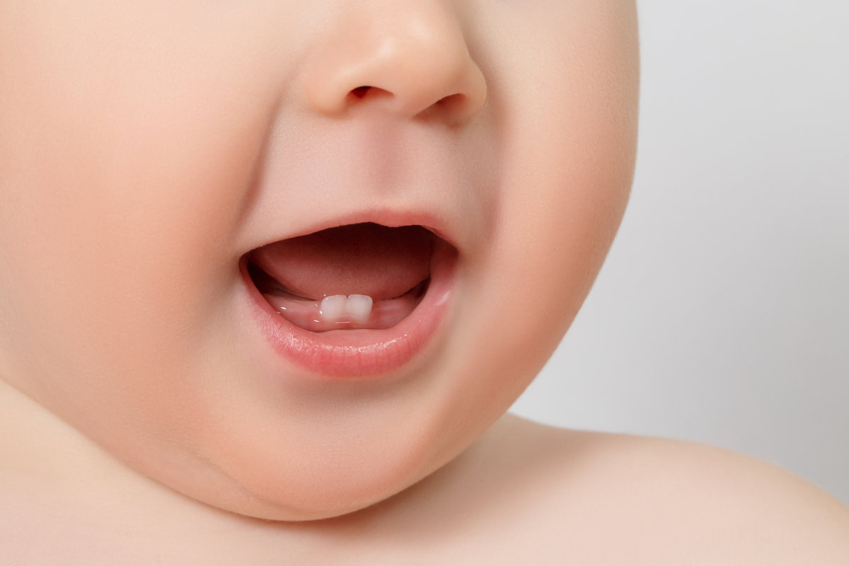 Why Do Baby Teeth Sometimes Come in Crooked and When Should I Be Concerned?