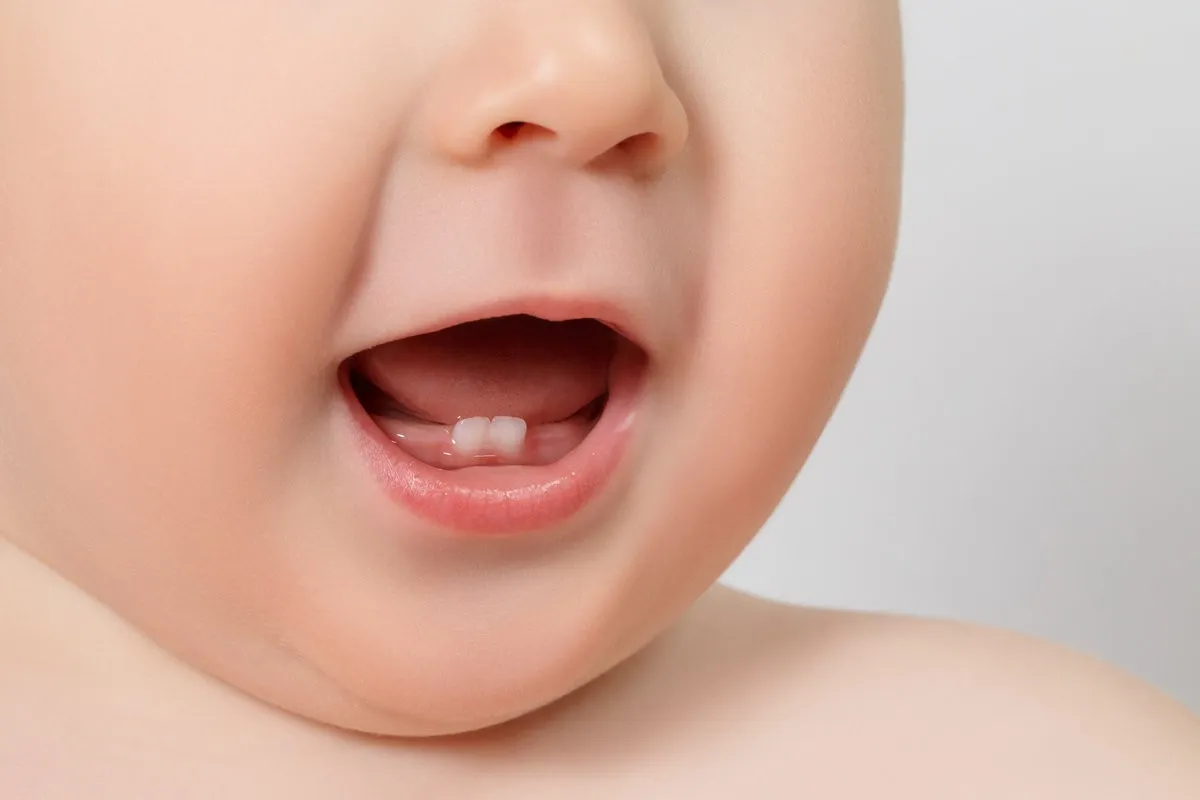 Why Do Baby Teeth Sometimes Come in Crooked and When Should I Be Concerned?