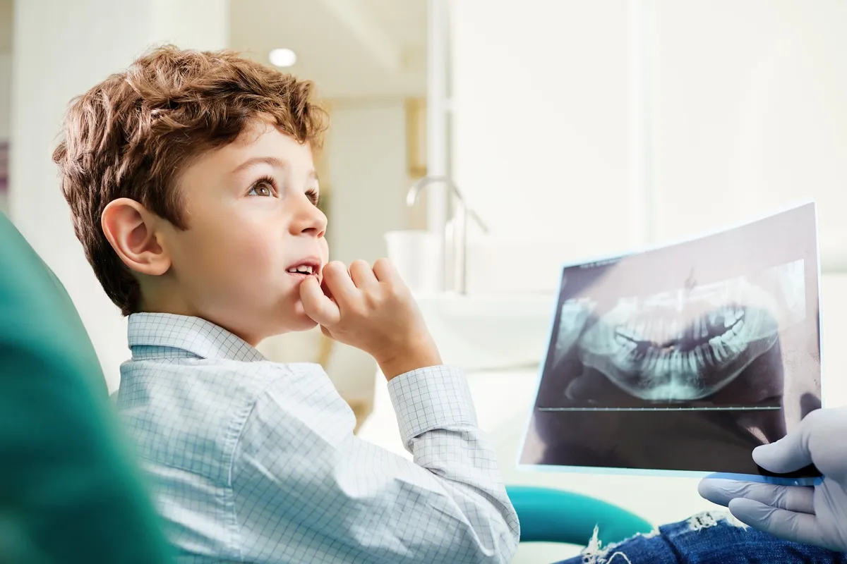 What Age Should Children Get Their First Dental X-Rays?
