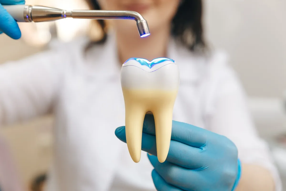 What Is the Difference Between Composite and Amalgam Fillings?