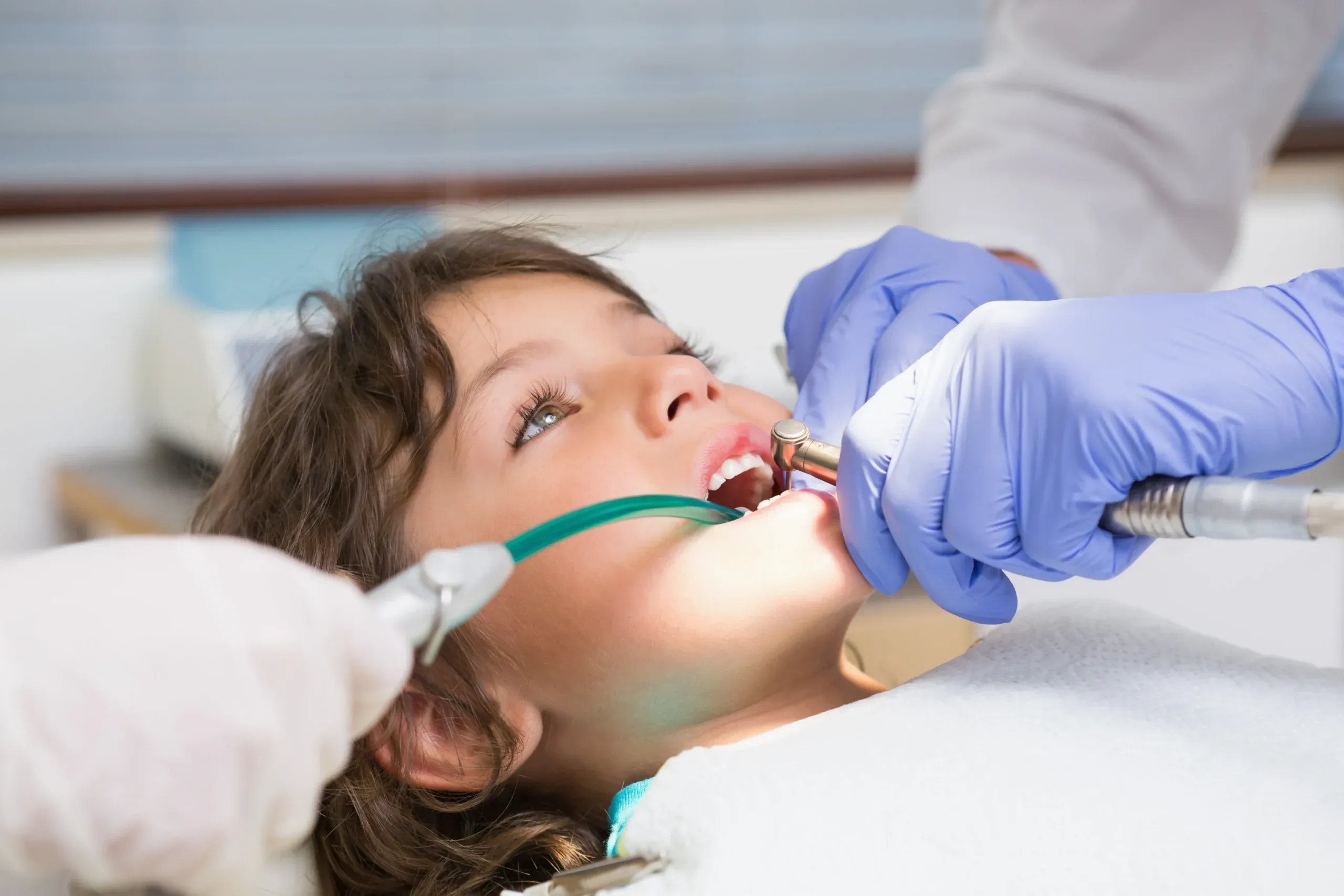What Is a Pediatric Pulpotomy and When Does My Child Need One?